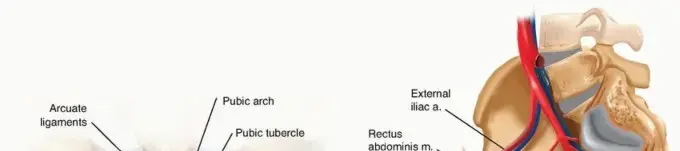 صورة توضيحية لـ إصابة ارتفاق العانة: الأسباب، الأعراض، وخيارات العلاج الشاملة لاستعادة حياتك الطبيعية