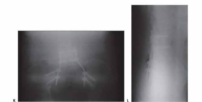 صورة طبية: جراحة أورام العجز: الحفاظ على وظائف الأمعاء والمثانة مع الأستاذ الدكتور محمد هطيف في صنعاء