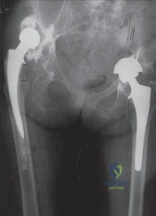 Clinical Image