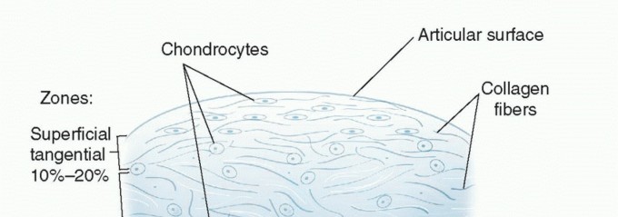 Osteochondral Autograft Plug: Your Solution for Cartilage Repair