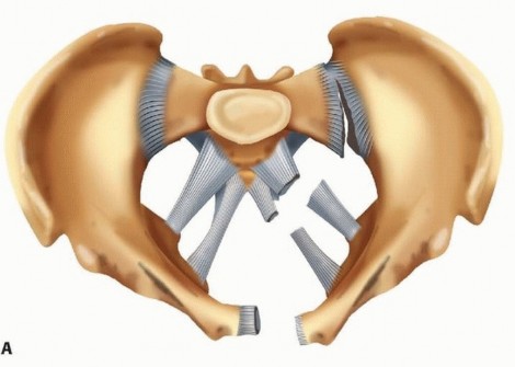 Emergency Fixation of the Pelvis: Control Bleeding & Restore Stability