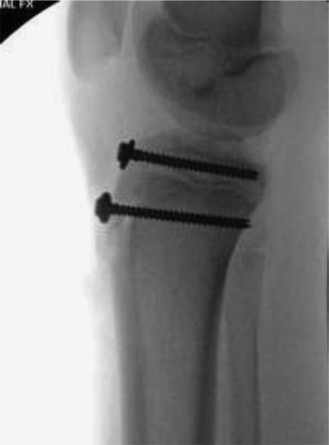 Illustration 2 for 9 Pediatrics Cases: Essential Insights on Rotation of the Foot
