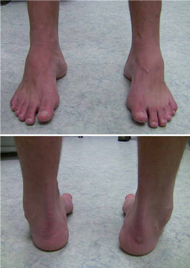 Illustration 91 for First Metatarsal Surgery: Expert Solutions for Foot & Ankle Pain