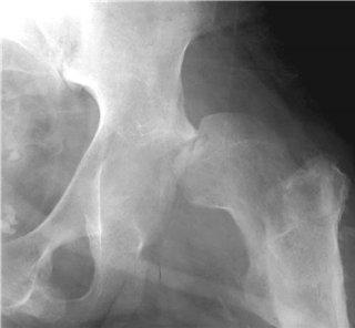 Illustration 8 for Ace Your FRCS: Key Questions in Trauma & Orthopaedics