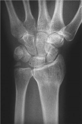 Illustration 11 for Master Hands and Paediatric Orthopaedics: Diagnose & Treat