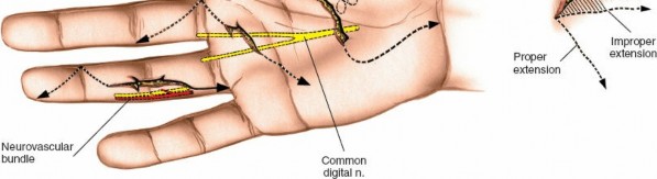 Illustration 146 for Essential Surgical Approaches: Uncover Every Aspect of the Wrist