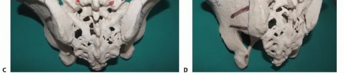 صورة طبية: جراحة أورام العجز: الحفاظ على وظائف الأمعاء والمثانة مع الأستاذ الدكتور محمد هطيف في صنعاء
