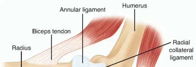 استبدال رأس الكعبرة: دليلك الشامل لاستعادة حركة كوعك في اليمن والخليج