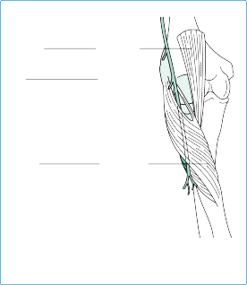 Illustration 74 for Radial Head Replacement: Solutions for Complex Elbow Injuries