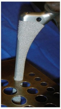 Illustration 15 for Revision THA: Why Extensively Porouscoated Cylindrical Stems Excel