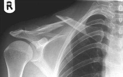 Illustration 18 for Ace Your FRCS: Key Questions in Trauma & Orthopaedics