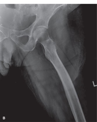 Illustration 2 for Mastering Oncology Cases: Multiple Myeloma & Bone Scan Nuances