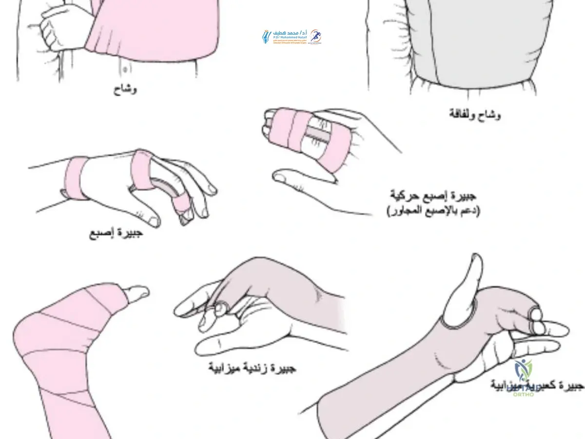 خلع المفصل: الأسباب، الأعراض وعلاج الانخلاع الفعال