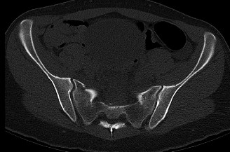 Illustration 10 for Master Orthopedic Spine Cases: Sharpen Your Diagnostic Skills