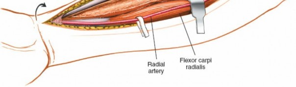 Illustration 20 for Mastering Approaches to the Upper Third of the Radius