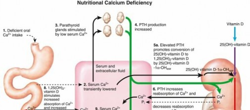 Nutritional Rickets: Your Nutritional Guide to Treatment