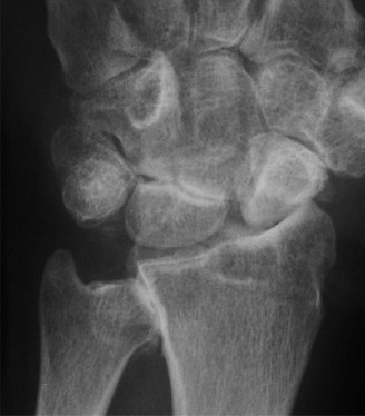 Illustration 2 for Unlock Wrist Diagnosis: Cases Guided by Figure Sunil Thirkannad