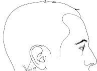 Exploring Every Approach to the Cervical: A Surgeon's Guide