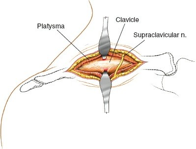 Illustration 4 for Essential Guide: Mastering Every Approach to the Shoulder