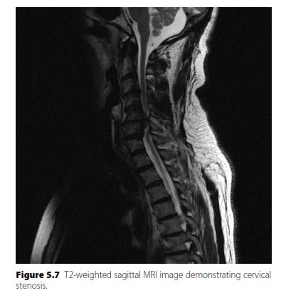 Illustration 5 for Oral Questions Lumbar: Master Spinal Stenosis & Myelopathy
