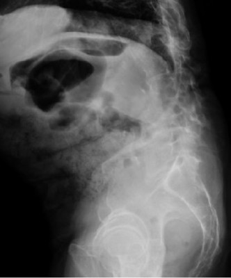Illustration 16 for Master Orthopedic Spine Cases: Sharpen Your Diagnostic Skills