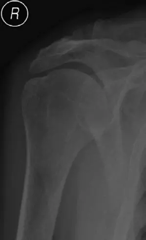 صورة توضيحية لـ دليلك الشامل لأمراض وإصابات المرفق: العلاج والرعاية مع الأستاذ الدكتور محمد هطيف في صنعاء