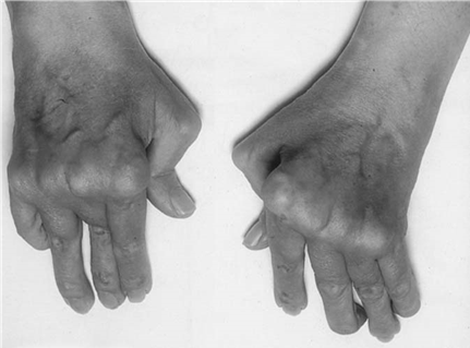 Illustration 4 for Master Hands and Paediatric Orthopaedics: Diagnose & Treat