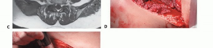 توضيح طبي: جراحة نقائل الحوض: حل شامل لآلام العظام واستعادة الحركة مع الأستاذ الدكتور محمد هطيف