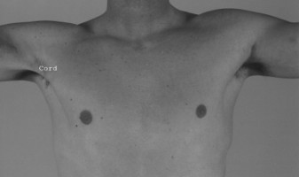 Master Diagnosis: Shoulder & Elbow Cases (Reproduced with Permission)