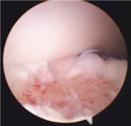 Illustration 32 for First Metatarsal Surgery: Expert Solutions for Foot & Ankle Pain