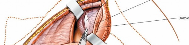 Illustration 177 for Essential Guide: Mastering Every Approach to the Shoulder