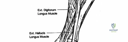 Illustration of tibia and fibula - Dr. Mohammed Hutaif