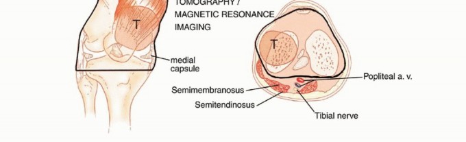 Clinical Image