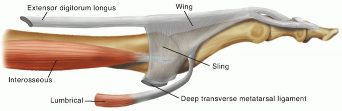 Illustration of extensor tendon transfer - Dr. Mohammed Hutaif