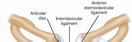 Optimizing SC Dislocation Repair After Medial Clavicle Resection
