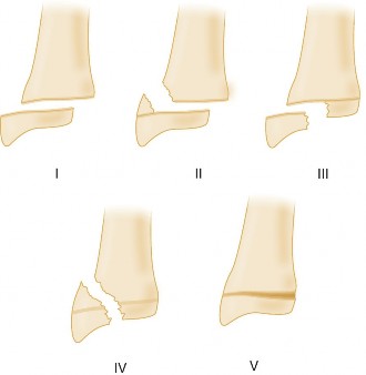 Illustration 7 for Pediatric Orthopedic Cases: Diagnose & Treat a Child's Wrist Fracture