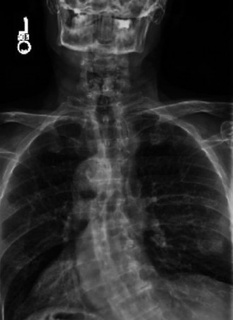 Illustration 13 for Master Orthopedic Spine Cases: Sharpen Your Diagnostic Skills