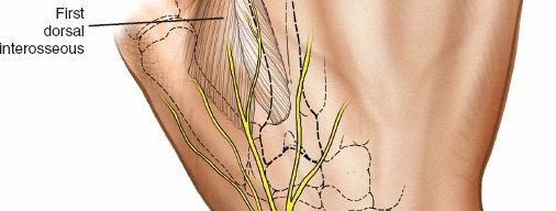 Illustration 6 for Expert Guide: Ulna and Wrist External Fixation Pin Placement