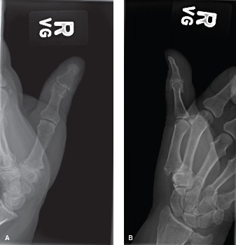 Illustration of patients who present - Dr. Mohammed Hutaif