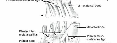 Illustration 6 for Mastering First MTP Joint & Forefoot Fractures: A Comprehensive Guide