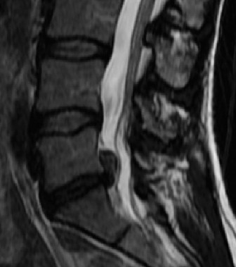 Illustration 7 for Master Orthopedic Spine Cases: Sharpen Your Diagnostic Skills