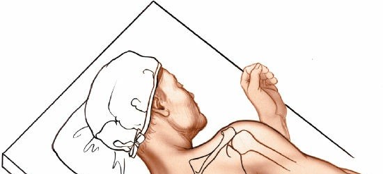 Unlocking the Posterior Shoulder Joint Approach: Techniques & Indications