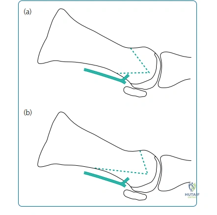 Clinical Image