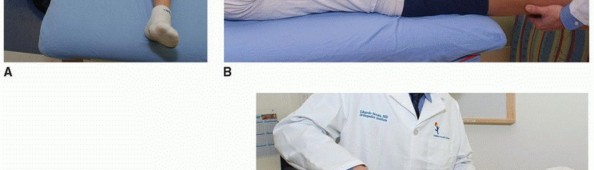Illustration 3 for Periacetabular Osteotomy: Realigning your hip via the superior pubic ramus