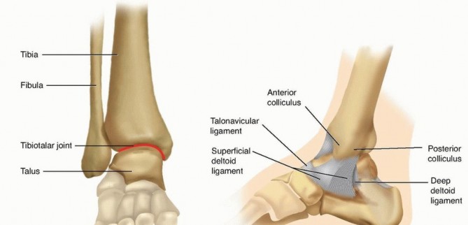 Ankle Fractures: Optimal Fixation of the Mature Ankle with ORIF