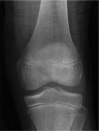 Illustration 3 for Pediatric Pain & Swelling: 16 Cases Solved & Diagnoses Revealed