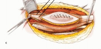 وصف طبي دقيق للمريض