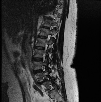 Illustration 18 for Spine Cases: Consider the Patient for Accurate Diagnosis