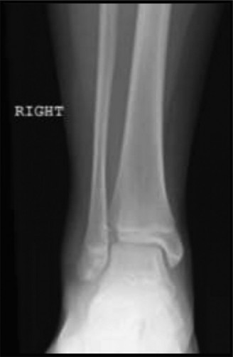Illustration 5 for 8 Pediatric Cases: Critical Decisions on Exits from the Physis