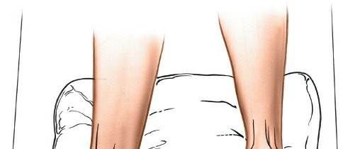 Optimal Ankle Anterior Approach: Surgical Technique & Uses